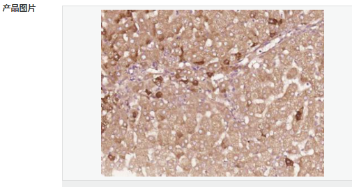 605413213044e.png image.png