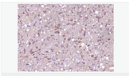 606bcfc4829d7.png image.png