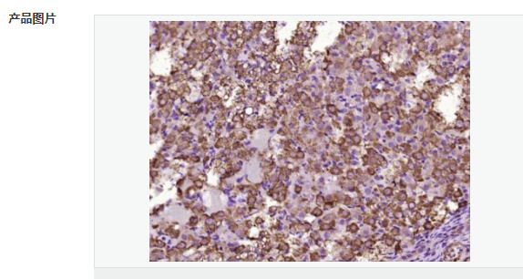 6077d80108754.png image.png