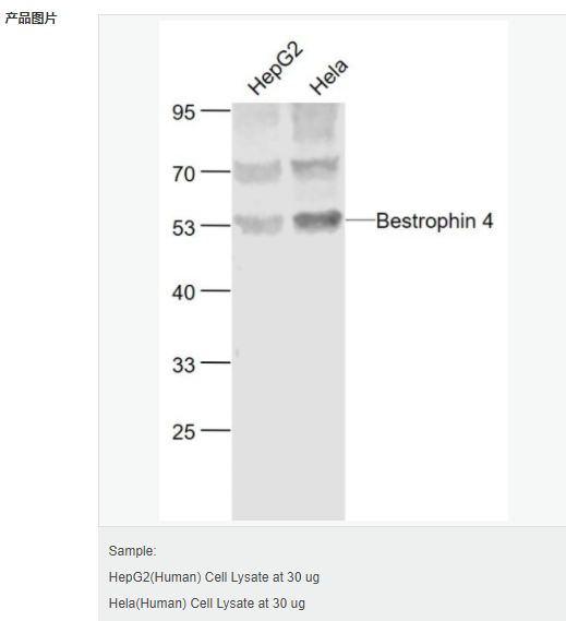 60793722bb3e3.png image.png